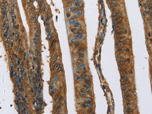 CAST Polyclonal Antibody Store at -20°C
