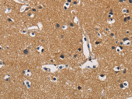 CBY1 Polyclonal Antibody Store at -20°C