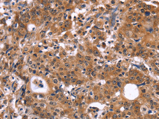 HACE1 Polyclonal Antibody Store at -20°C