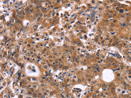 HACE1 Polyclonal Antibody Store at -20°C