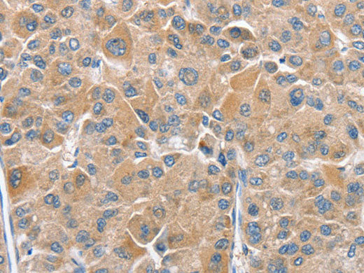 CHMP4B Polyclonal Antibody Store at -20°C