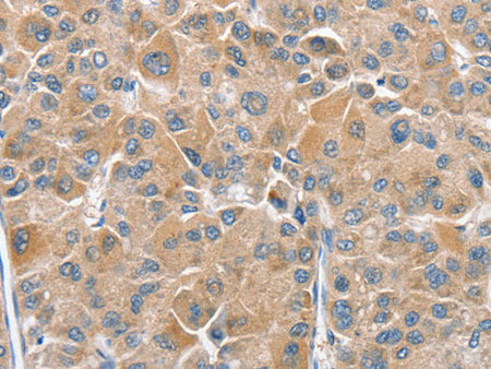 CHMP4B Polyclonal Antibody Store at -20°C