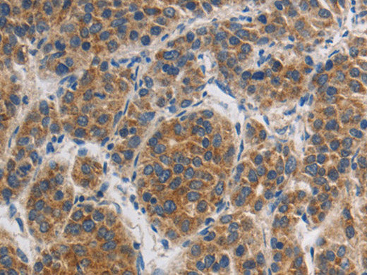 GRIN1 Polyclonal Antibody Store at -20°C