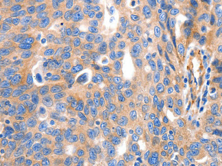 IGFBP7 Polyclonal Antibody Store at -20°C
