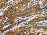 Claudin 2 Polyclonal Antibody Store at -20°C