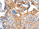 Claudin 1 Polyclonal Antibody Store at -20°C