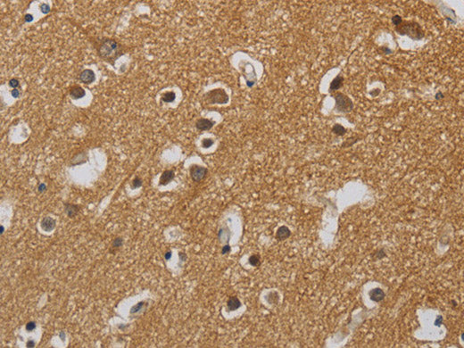 KIF4A Polyclonal Antibody Store at -20°C