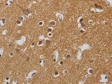 KIF4A Polyclonal Antibody Store at -20°C