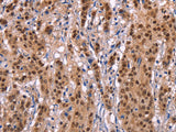 Ephrin A5 Polyclonal Antibody Store at -20°C
