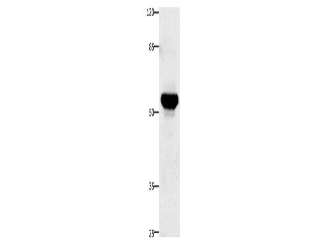 TNFRSF21 Polyclonal Antibody