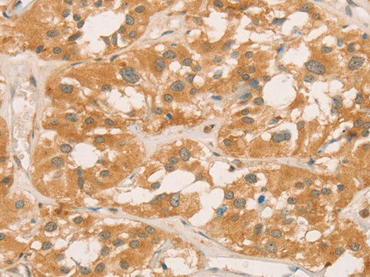 CPB1 Polyclonal Antibody Store at -20°C