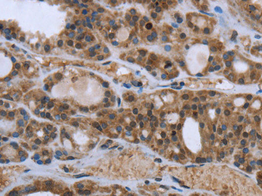 GGCX Polyclonal Antibody Store at -20°C