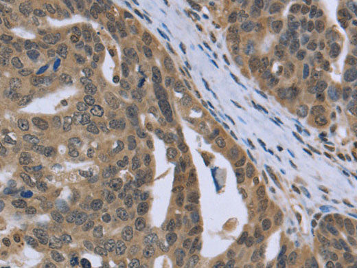 PTK2B Polyclonal Antibody Store at -20°C