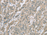EDA2R Polyclonal Antibody Store at -20°C