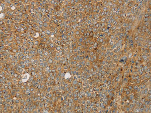STX16 Polyclonal Antibody Store at -20°C