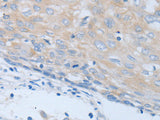 CHRNA7 Polyclonal Antibody Store at -20°C