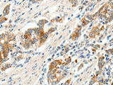 SCN9A Polyclonal Antibody Store at -20°C