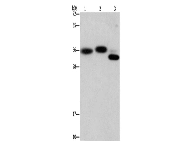 CAPZA2 Polyclonal Antibody