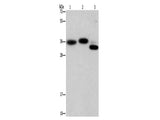 CAPZA2 Polyclonal Antibody