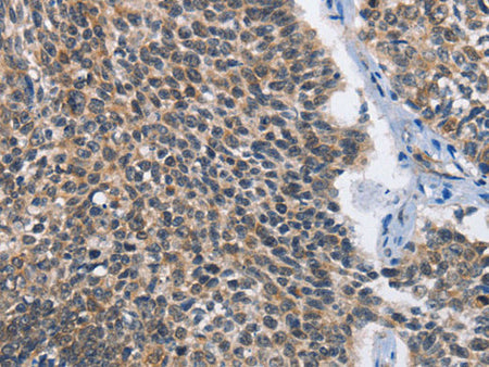MAD2L1BP Polyclonal Antibody Store at -20°C