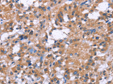 GPR172B Polyclonal Antibody Store at -20°C