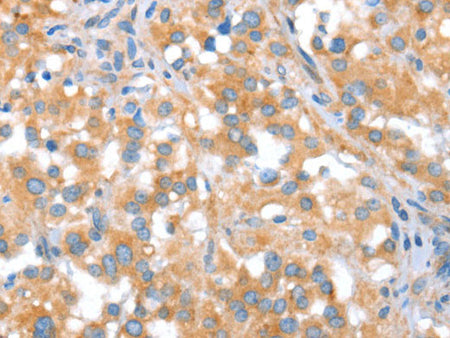 ST14 Polyclonal Antibody Store at -20°C