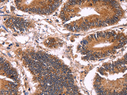 CCDC106 Polyclonal Antibody Store at -20°C