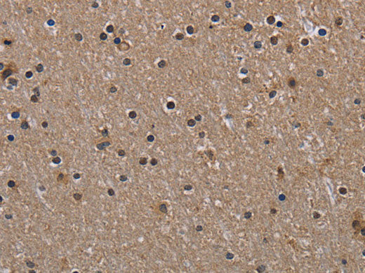 HIF1 alpha Polyclonal Antibody