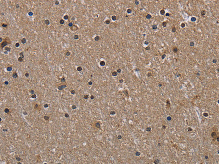 HIF1 alpha Polyclonal Antibody
