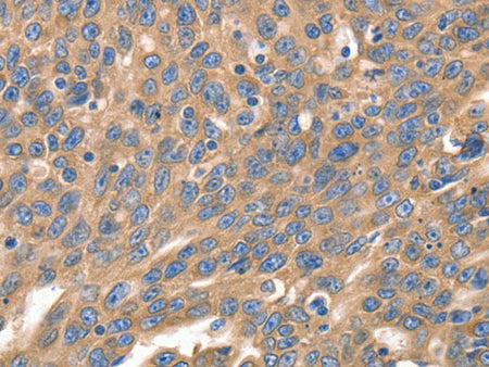 IRF1 Polyclonal Antibody Store at -20°C