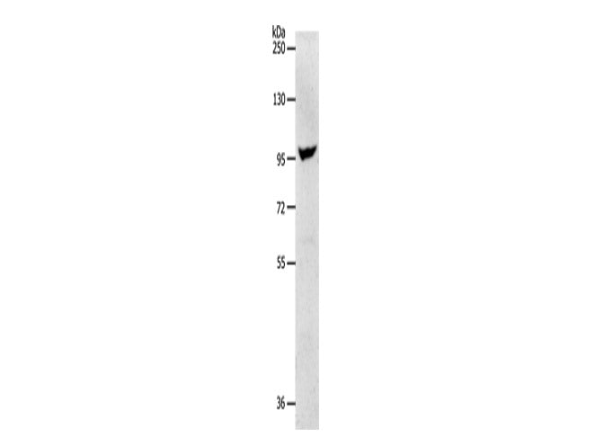 NFATC2 Polyclonal Antibody Store at -20°C