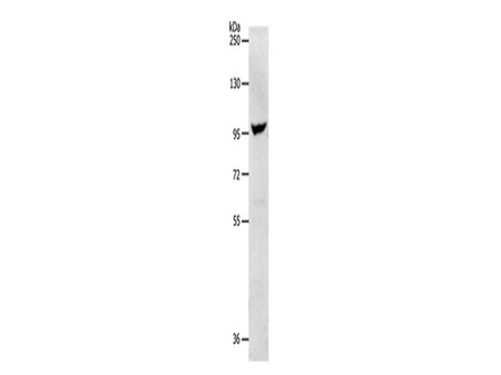 NFATC2 Polyclonal Antibody Store at -20°C