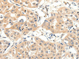 SLC27A1 Polyclonal Antibody Store at -20°C
