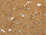 AKAP12 Polyclonal Antibody
