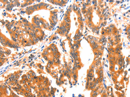AK5 Polyclonal Antibody Store at -20°C