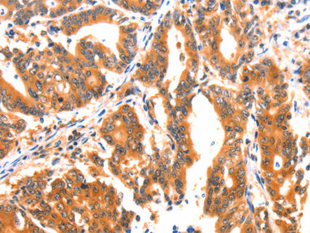 AK5 Polyclonal Antibody Store at -20°C