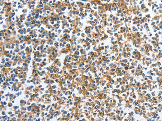 CKAP2 Polyclonal Antibody Store at -20°C