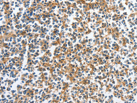 CKAP2 Polyclonal Antibody Store at -20°C