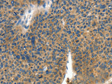COL4A2 Polyclonal Antibody