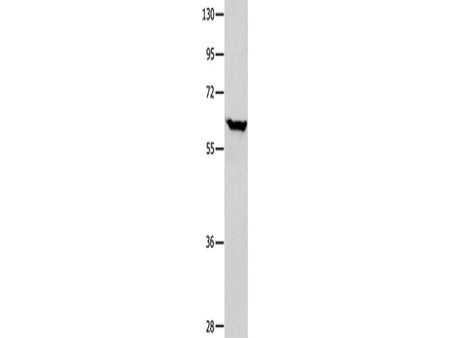 DNAJC7 Polyclonal Antibody Store at -20°C
