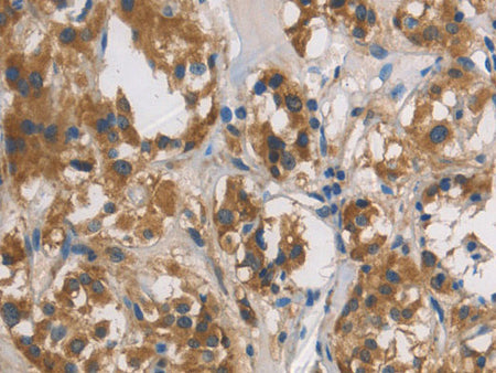 DUSP26 Polyclonal Antibody Store at -20°C