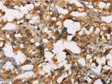 SENP1 Polyclonal Antibody Store at -20°C