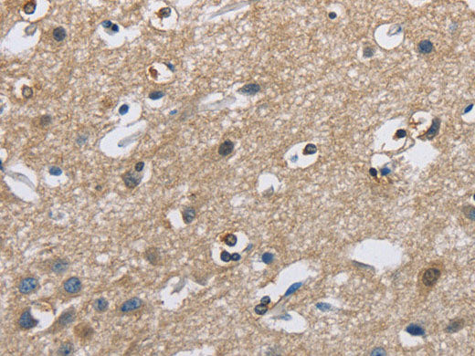 CAB39L Polyclonal Antibody Store at -20°C
