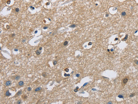 CAB39L Polyclonal Antibody Store at -20°C