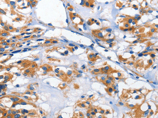 HK2 Polyclonal Antibody Store at -20°C