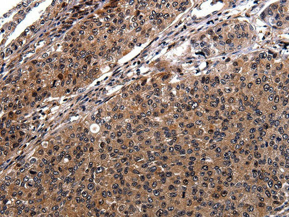 RAB41 Polyclonal Antibody Store at -20°C
