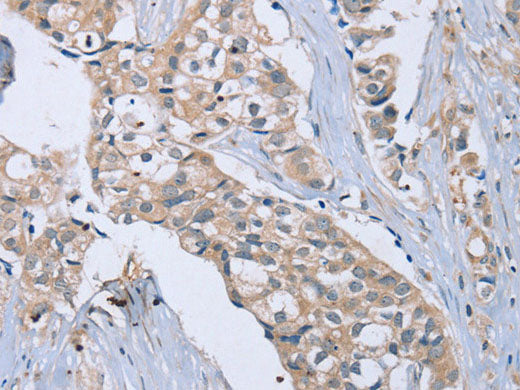 EDA Polyclonal Antibody Store at -20°C