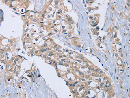 EDA Polyclonal Antibody Store at -20°C