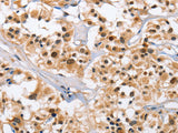 NCAPD3 Polyclonal Antibody