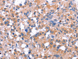 ELP2 Polyclonal Antibody Store at -20°C